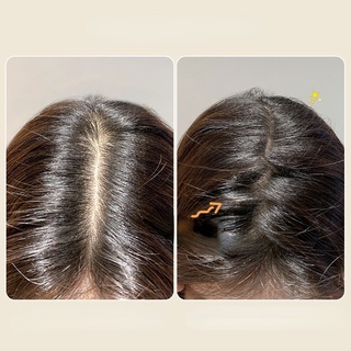 Kẹp Tóc Z-comb Tạo Kiểu Tóc Thời Trang Hàn Quốc