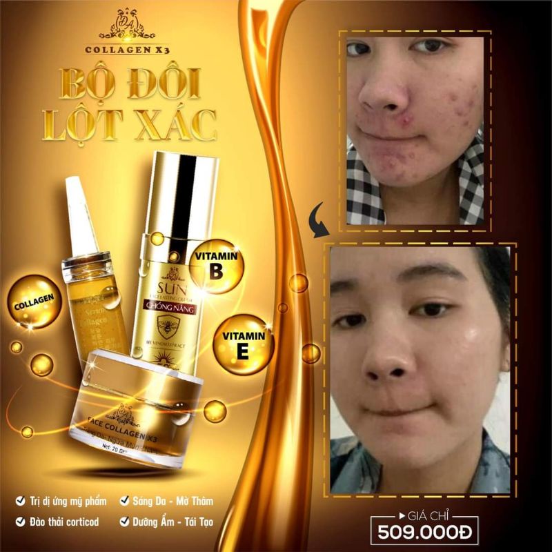COMBO FACE+SERUM+CHỐNG NẮNG, MP ĐÔNG ANH CHÍNH HÃNG