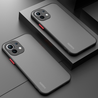 Ốp Lưng Mờ Nửa Trong Suốt Cho Xiaomi Mi 11 Lite 5G NE 12 12X 11T Pro 10T Lite Vỏ Giáp Ốp Lưng