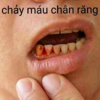 THUỐC RĂNG MIỆNG GIA TRUYỀN HỌ LĂNG
