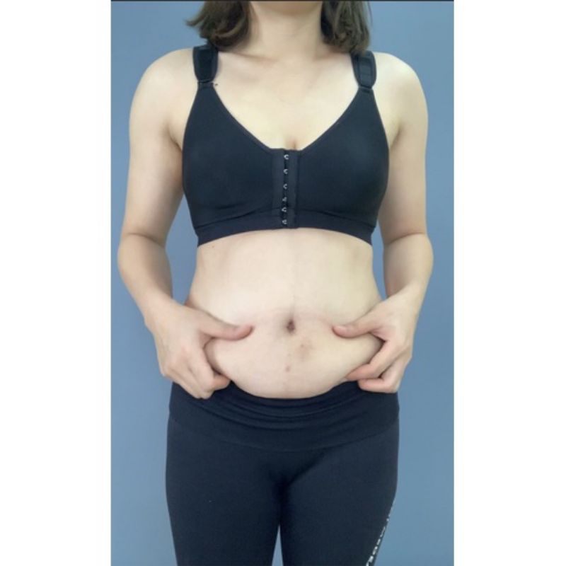 Đai Nịt Bụng Vitalatex Cải Tiến Mở Hông Lưới Thông Hơi Siết Eo Che Mỡ Lưng Hoàn Hảo