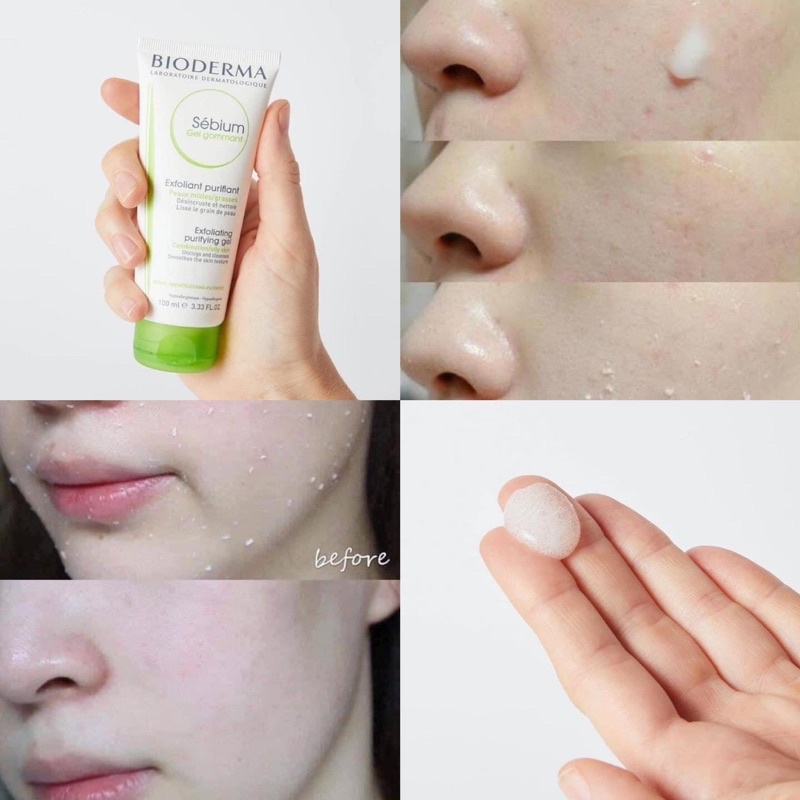 Gel Tẩy Tế Bào Chết Làm Mịn Da Bioderma Sebium Gel Gommant 100ml