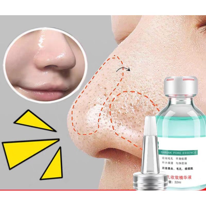 CHÍNH HÃNG — Serum Se Khít Lỗ Chân Lông Thần Thánh