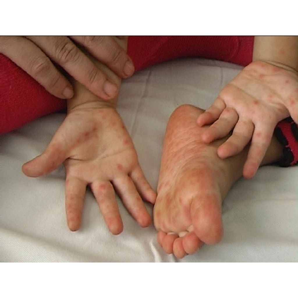 Xịt sát khuẩn rửa tay nhanh và bề mặt vật dụng Clincare SH 70ml