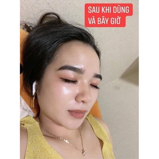[HÀNG CHÍNH HÃNG] Serum Cốt Mụn Bạch Sen LSKIN - Mỹ Phẩm Đan Thy