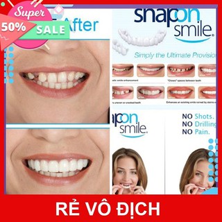 Nẹp răng Snapon Smile