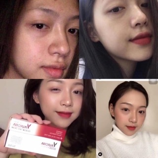 Combo Dưỡng Da Hoàn Hảo Vaurora