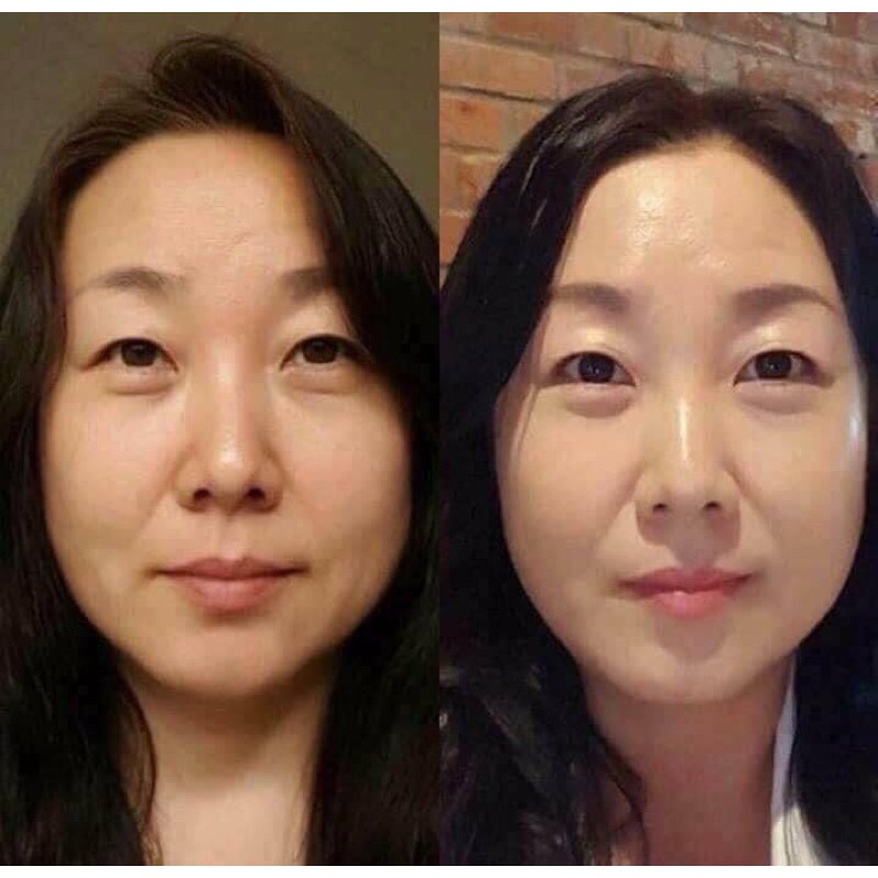 Tế bào gốc Eldas