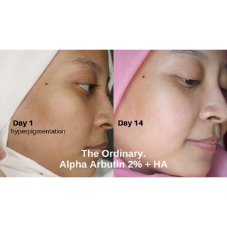 Serum The Ordinary Alpha Arbutin 2%+ HA