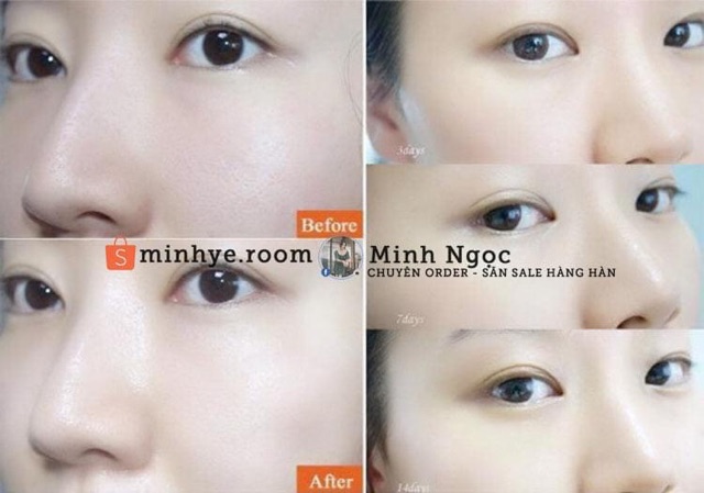 Bột Collagen Uống Lựu Đỏ Bio Cell Hàn Quốc Thần Dược Đẹp Da Giảm Cân Thải Độc Tố Mờ Nám | BigBuy360 - bigbuy360.vn