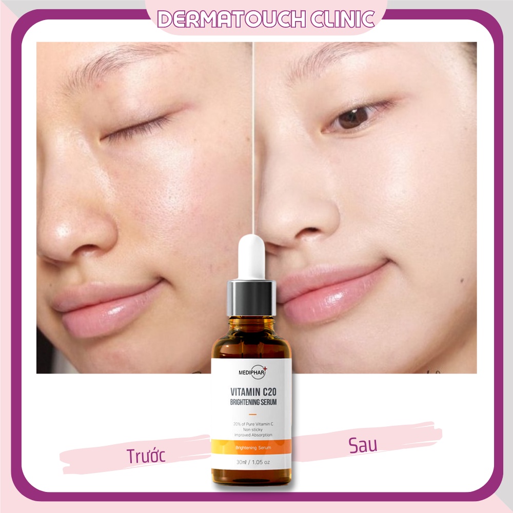 ✅ Serum Vitamin C dưỡng trắng da Mediphar 30mL