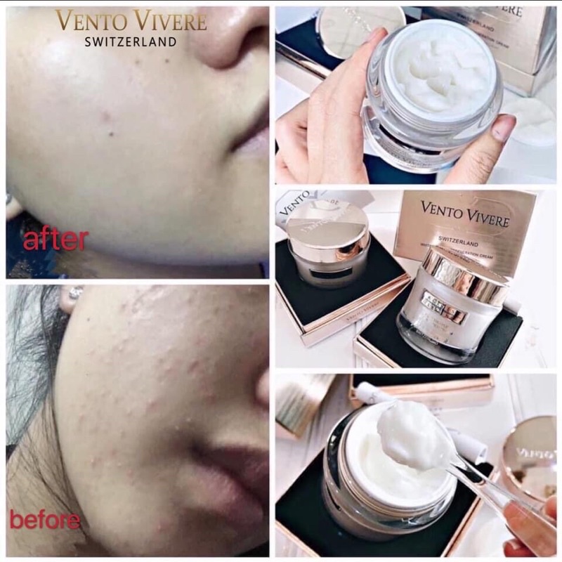 Kem Dưỡng Trắng Nâng Cơ Chống Lão Hóa Vento Viver