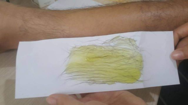 Combo wax tẩy lông vĩnh viễn (Handmade) | BigBuy360 - bigbuy360.vn