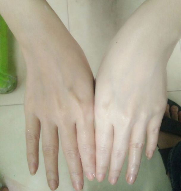 Dung dịch trắng da