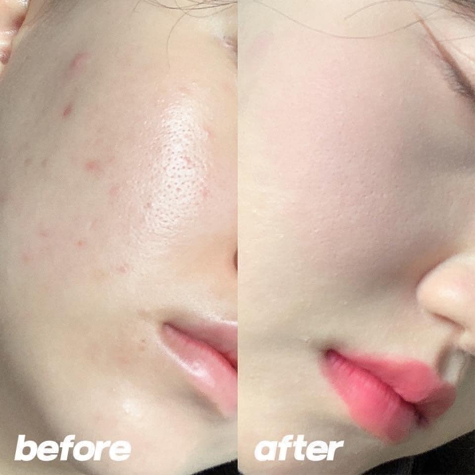 Phấn Nước LANEIGE Neo Cushion Matte Xanh Mint Tone 21N SPF42 PA++ Hàn Quốc