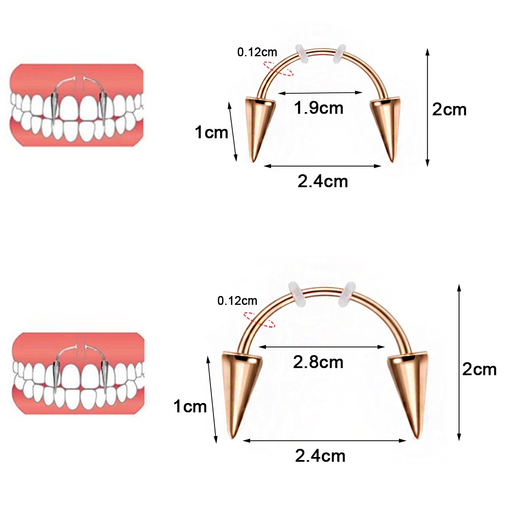 Khuyên Xỏ Răng Giả Thời Trang Cá Tính