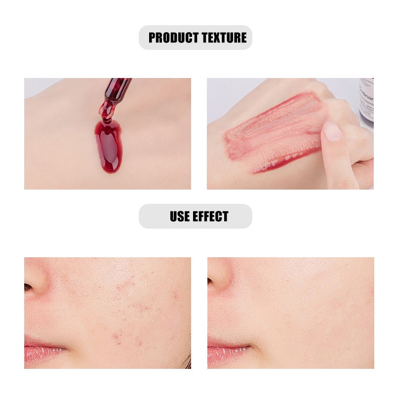 [Hàng mới về] Tinh chất loại bỏ mụn đầu đen The Ordinary AHA 30% BHA 2% dạng lột làm sáng da 30ml