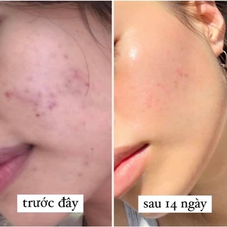 𝐓𝐢𝐧𝐡 𝐜𝐡𝐚̂́𝐭 𝐝𝐮̛𝐨̛̃𝐧𝐠 𝐚̂̉𝐦 𝐩𝐡𝐮̣𝐜 𝐡𝐨̂̀𝐢 𝐝𝐚 - 𝐒𝐞𝐫𝐮𝐦 𝐊𝐥𝐚𝐢𝐫𝐬 𝐌𝐢𝐝𝐧𝐢𝐠𝐡𝐭 𝐁𝐥𝐮𝐞 𝐘𝐨𝐮𝐭𝐡 𝐀𝐜𝐭𝐢𝐯𝐚𝐭𝐢𝐧𝐠 𝐃𝐫𝐨𝐩 𝟐𝟎𝐦𝐥
