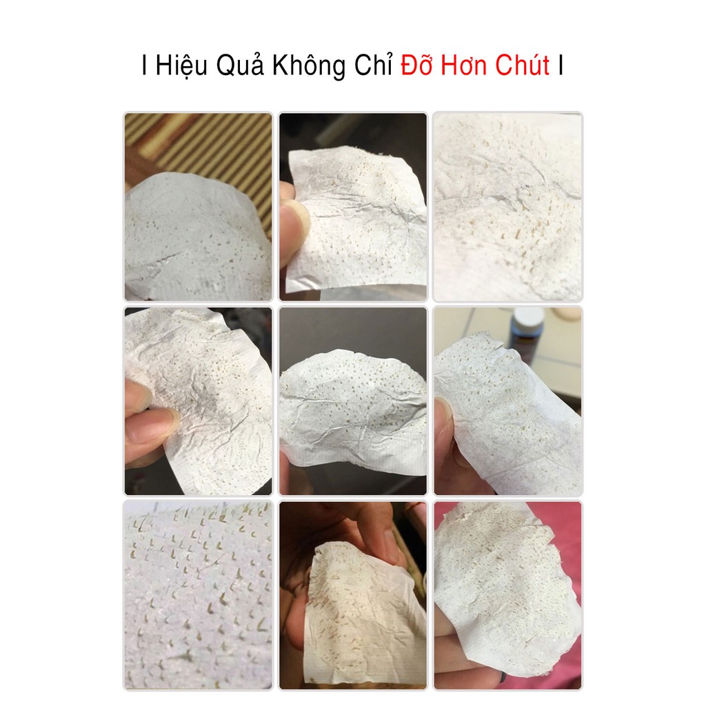 [CHÍNH HÃNG] LANBENA Gel Lột Mụn Đầu Đen Hộp Trắng Ngăn Ngừa Và Loại Bỏ Mụn Cám Làm Sạch Da Thu Nhỏ Lỗ Chân Lông 30g