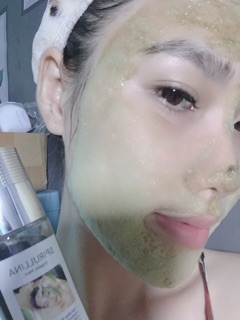 NẠ TẢO XOẮN SỦI BỌT THẢI ĐỘC