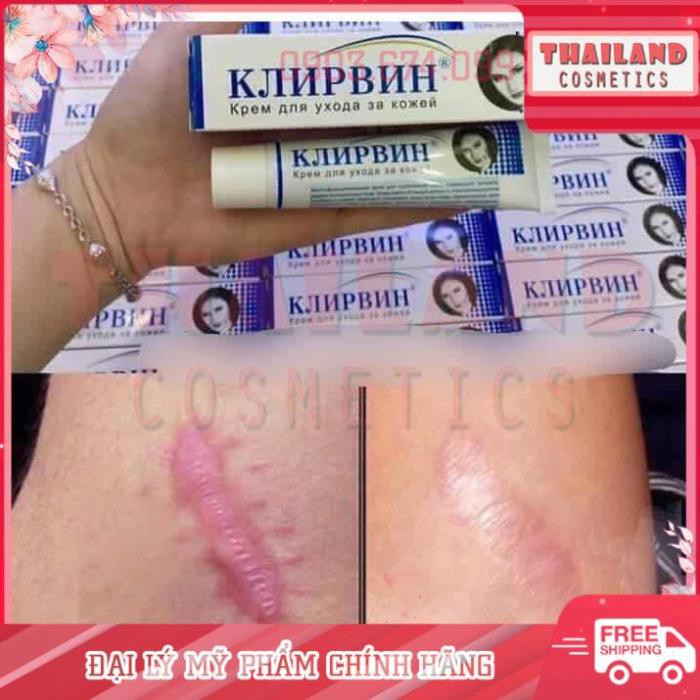 Kem hỗ trợ mờ sẹo mờ thâm, rạn da Klirvin Nga 25G