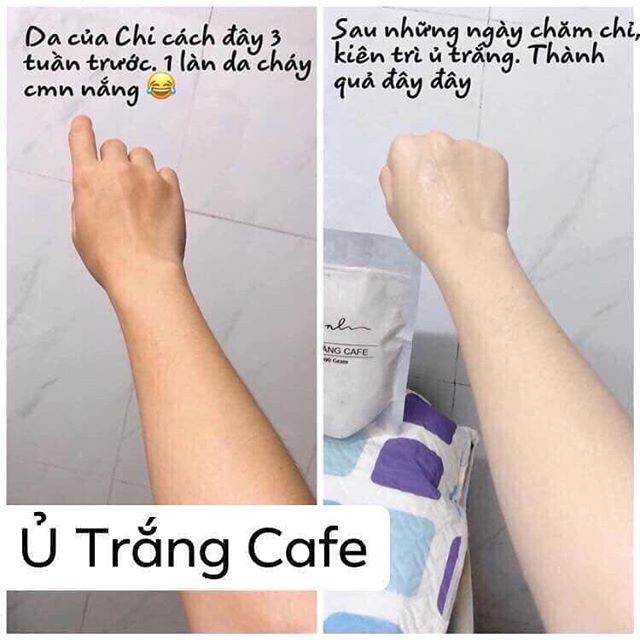 Ủ TRẮNG CAFE 300g Mẫu Mới ( Chính Hãng )