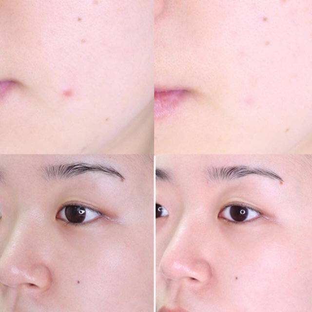 ( Sẵn ) Tinh chất sẹo mụn ốc sên SOME BY MI SNAIL TRUECICA MIRACLE REPAIR SERUM | BigBuy360 - bigbuy360.vn