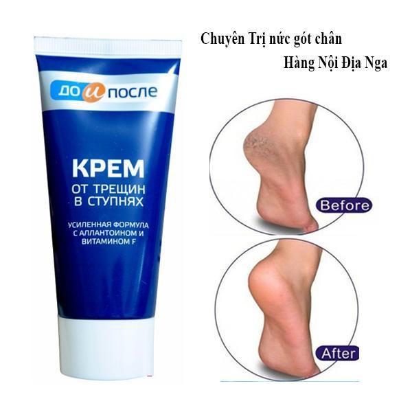 Kem Nứt Gót Chân Kpem Apteka chính hãng Nga 50ML