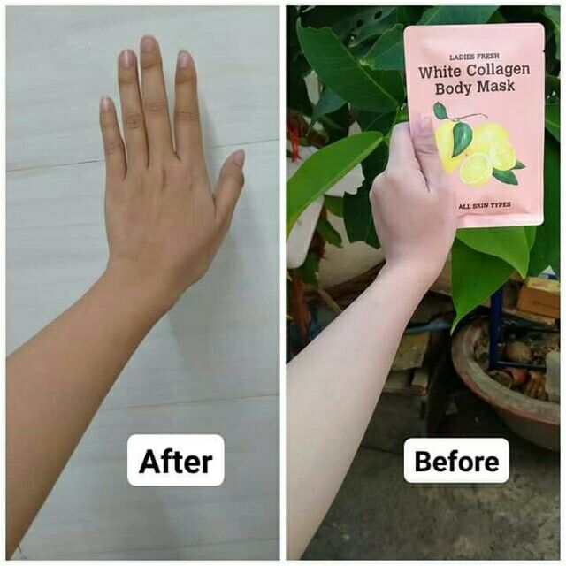 Ủ Trắng Chanh QLADY Chính Hãng | BigBuy360 - bigbuy360.vn