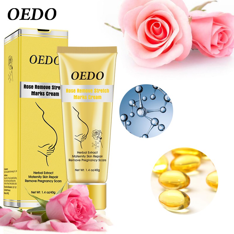 OEDO Rose Remove Stretch Marks Cream 40g | BigBuy360 - bigbuy360.vn