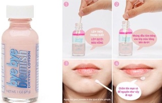 Chấm mụn BYE BYE BLEMISH DRYING LOTION
