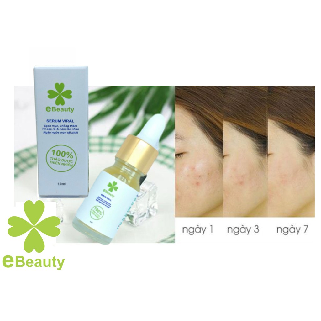 Serum tri mụn xóa thâm sẹo rổ nám tàn nhang EBeauty Viral 10ml | BigBuy360 - bigbuy360.vn