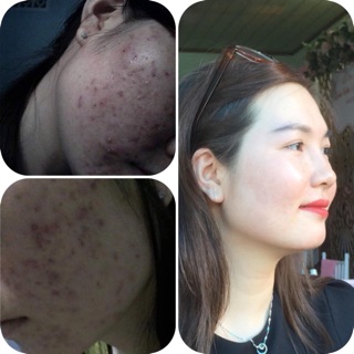 Serum Thảo Mộc OGANA