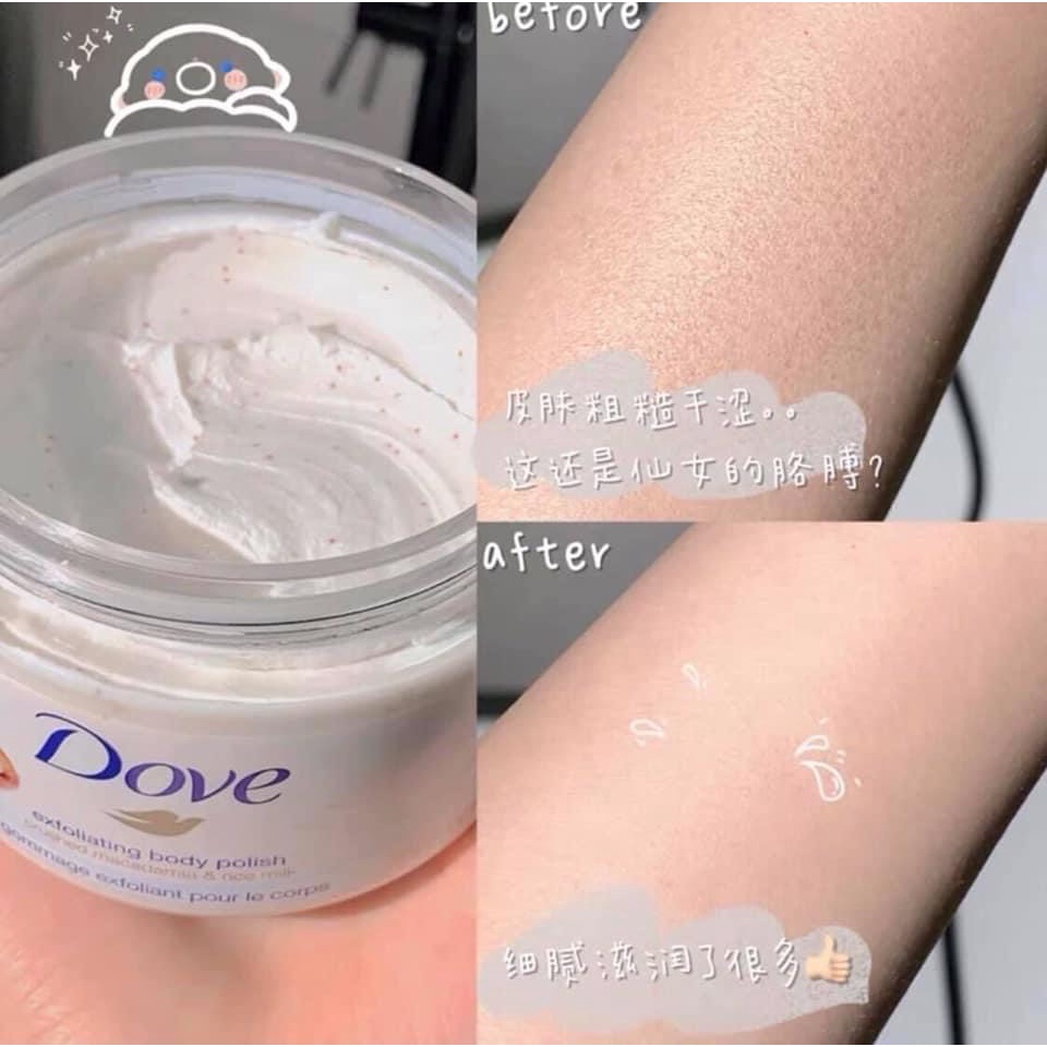 Kem Tẩy Da Chết Body Dove