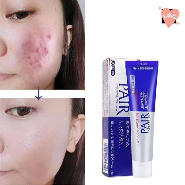 Kem chấm mụn Pair Acne W Cream Nhật Bản 24gr