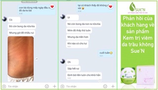 KEM TRỊ VIÊM DA TRẦU KHÔNG SUE’N