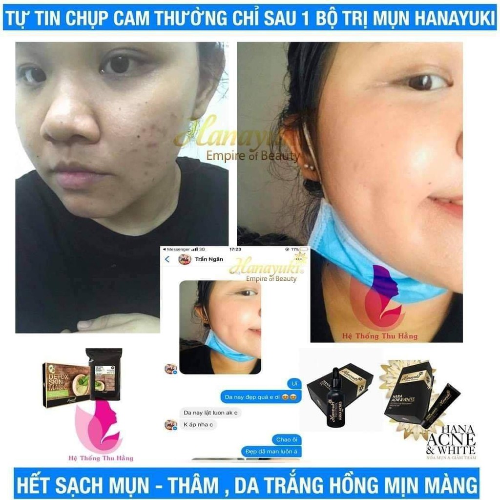 [CHÍNH HÃNG 100%] Kem Mụn Trắng Da Hana Acne & White