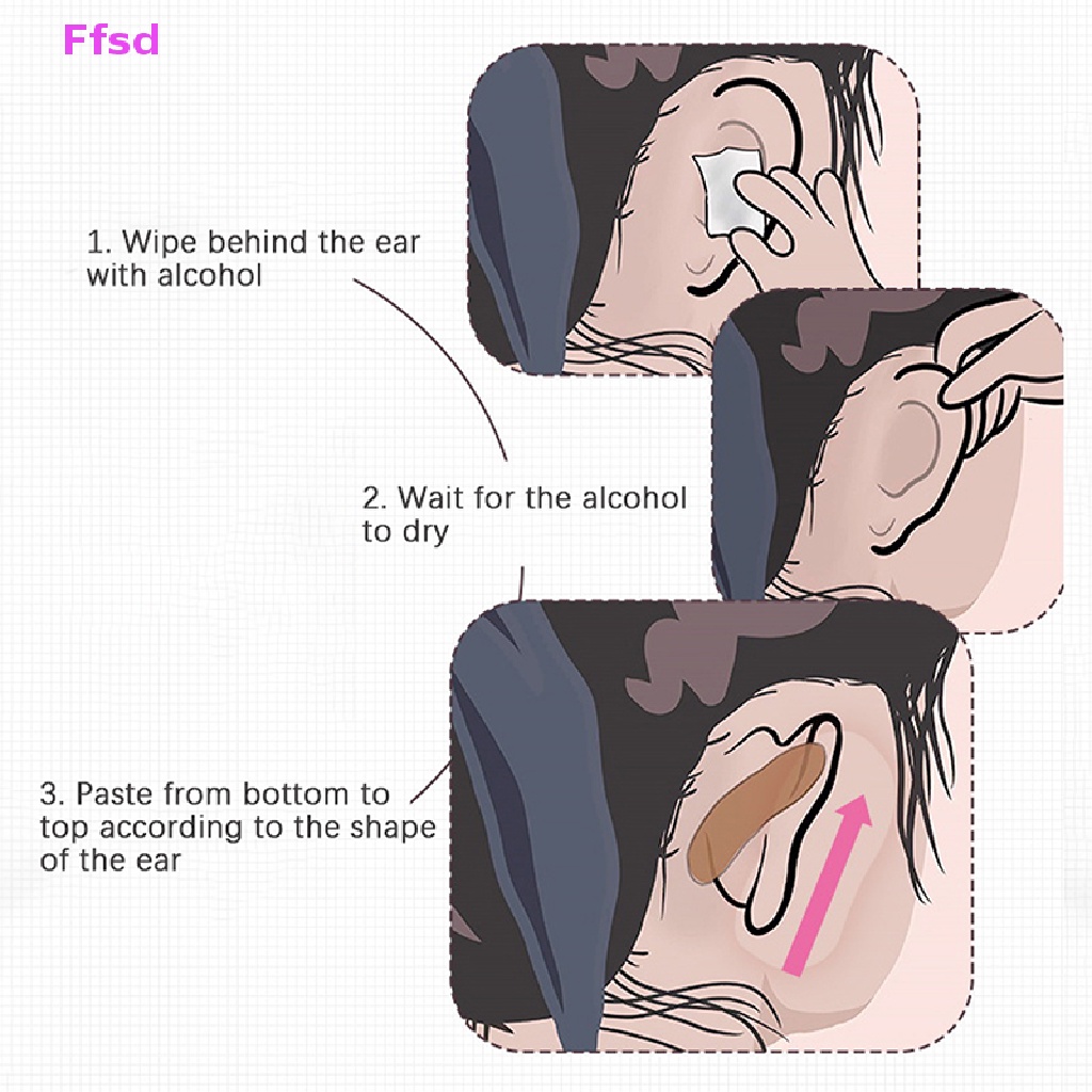 {Ffsd} Miếng Dán Chỉnh Sửa Tai Elf Hình Chữ V * Hàng Bán Chạy