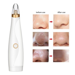 3 in 1 Blackhead Remover Máy hút mụn đầu cầm tay