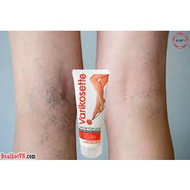 Kem suy giãn tĩnh mạch Varikosette giúp giảm đau mỏi, mất thẩm mỹ do suy giãn tĩnh mạch gây ra, cam kết hàng chuẩn 100%