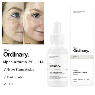 [ Bill Hàn- Chính hãng] The Ordinary - Alpha Arbutin 2% + HA serum làm mờ nám, tàn nhang, thâm mụn