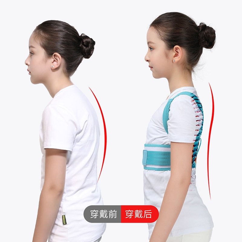 Đai chống gù lưng trẻ em Chữa gù lưng hiệu quả Định Hình Cột Sống