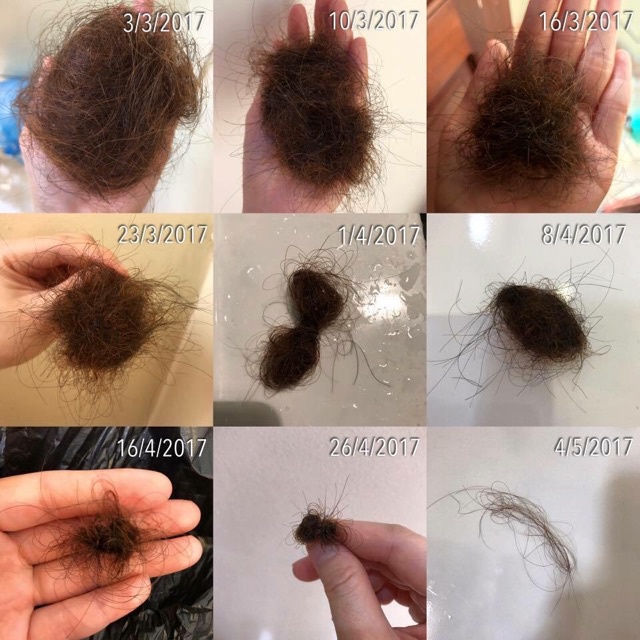 ALLME - Dầu gội RAUSCH cho tóc gàu 40ml