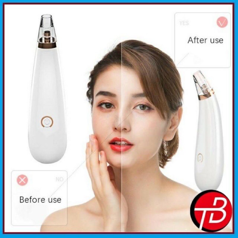 Máy hút mụn đầu đen cầm tay