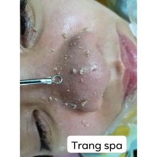 Ủ mụn xanh