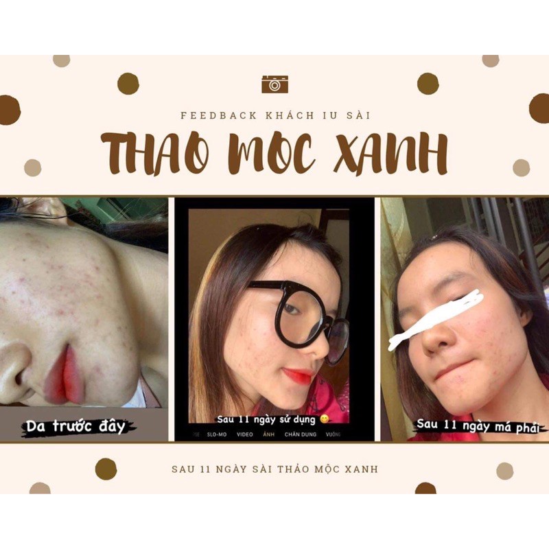 Serum thảo mộc xanh 💥FREESHIP💥 | BigBuy360 - bigbuy360.vn