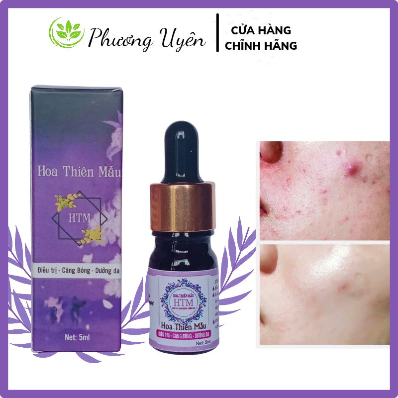 Serum Hoa Thiên Mẫu Giảm Mụn - Hiệu Quả Sau 24h