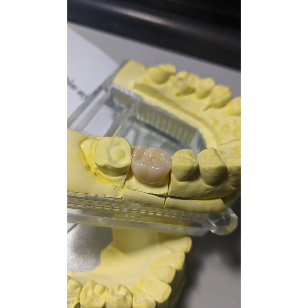 Phôi sứ Zirconia ST sản xuất răng CADCAM