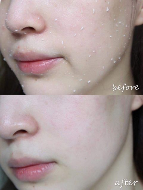 Tẩy da chết Cure Nhật Bản 250g.