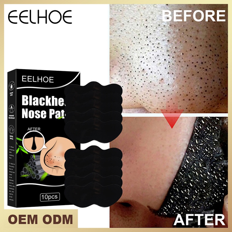 Hộp 10 Miếng Dán Lột Mụn Đầu Đen Vùng Mũi Làm Sạch Lỗ Chân Lông